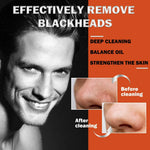 Blackhead Removal Strips view 4