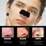Blackhead Removal Strips view 5